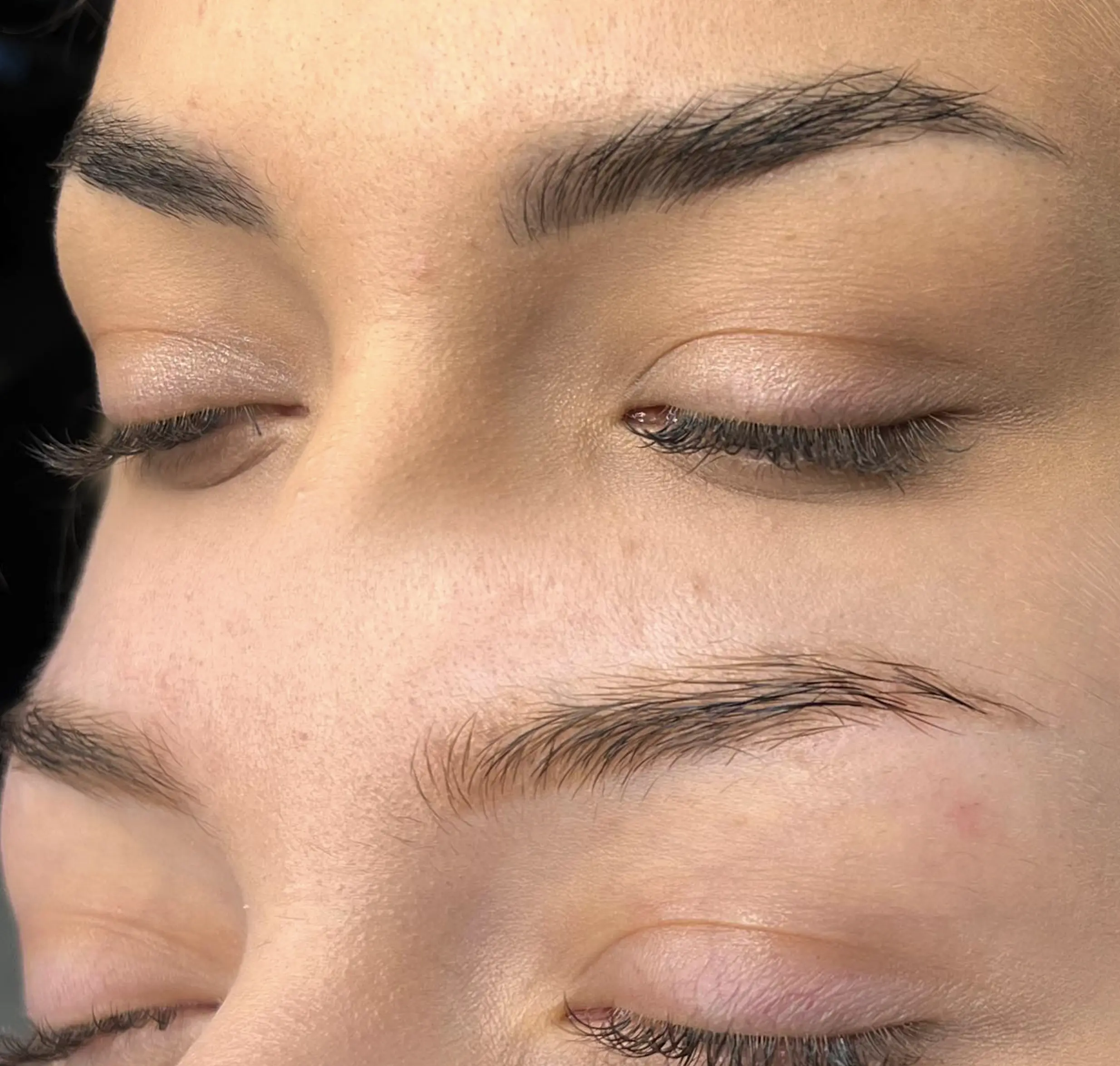 eyebrow tattoo removal
